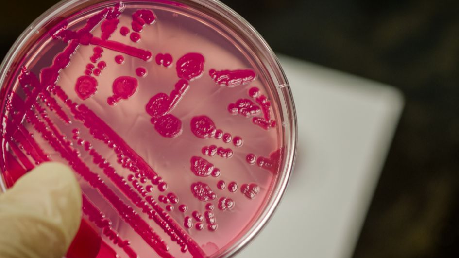 Das Bild zeigt eine Bakterienkulturplatte mit Salmonellenkolonie.